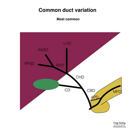 Common Bile Duct Radiology Reference Article Radiopaedia Org