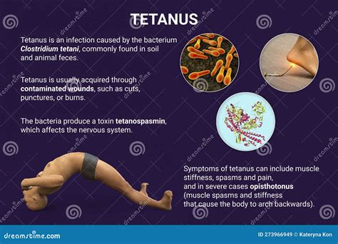 Tetanus Syndrom 3d Abbildung Stock Abbildung Illustration Von Protein Abbildung 273966949