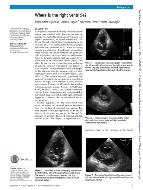 PDF Where Is The Right Ventricle BMJ Case Reports Video 2