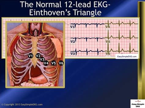 The Normal 12 Lead Ekg And Einthovens Triangle Video Dailymotion