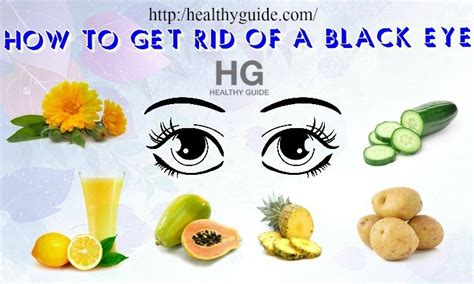 28 Tips How To Get Rid Of A Black Eye And Swelling Fast Overnight