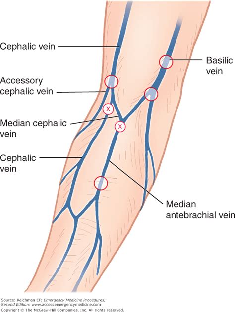 Chapter 48 Venipuncture And Peripheral Intravenous Access Cephalic Vein Vein Thrombosis