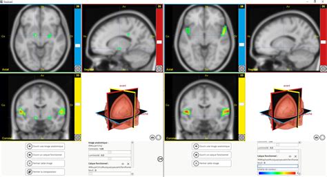 Tp Plasticité Cérébrale Ts Eduanatomist