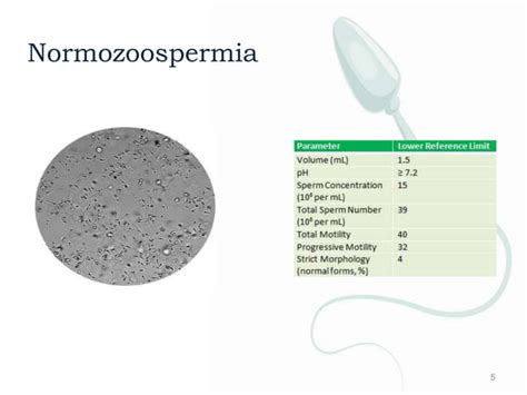 Azoospermia