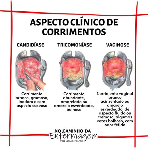 Infec Es Sexualmente Transmiss Veis O Que S O Tipos Causas E