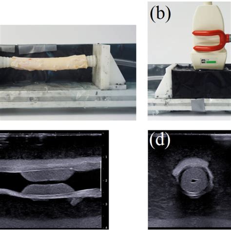 Experimental Setup A Porcine Aorta Mounted On Customized End Fixture