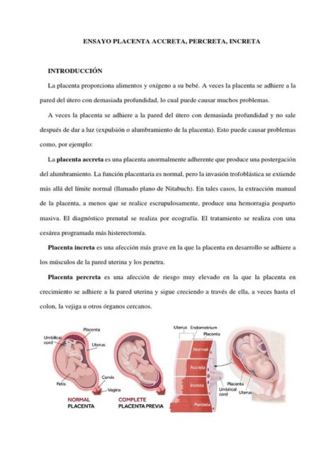 Ensayo Placenta Accreta Increta Percreta Pdf El Embarazo Parto