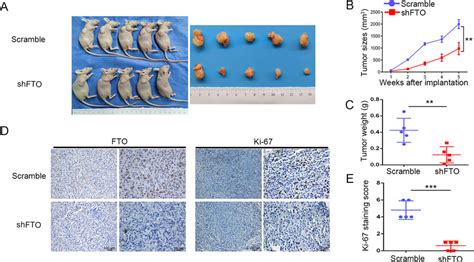 Silencing FTO Inhibited Pancreatic Tumor Growth In Nude Mouse Models A