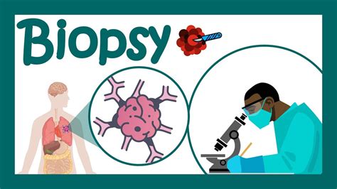 Biopsy What Are Biopsies Used To Diagnose How Many Types Of Biopsy