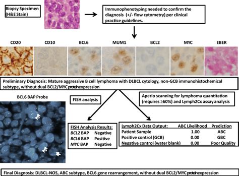 Example Case Illustrating Proposed Tentative Workflow For Dlbcl