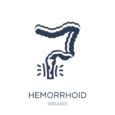 930 Hemorrhoid Stock Illustrations Royalty Free Vector Graphics