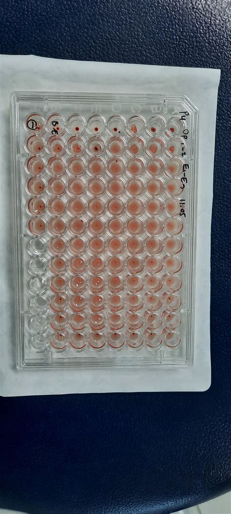 How to interpret confusing hemagglutination assay result? | ResearchGate