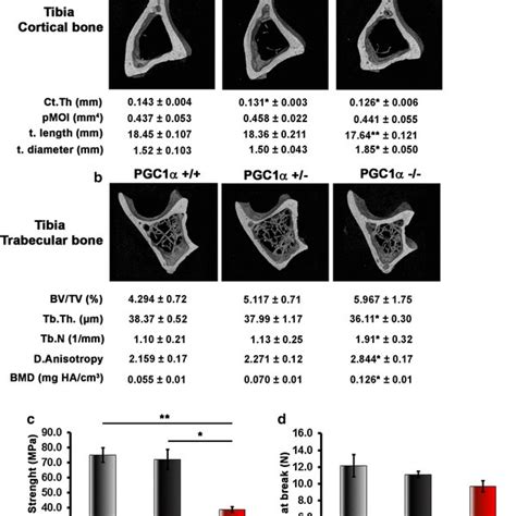 Effect Of Pgc1α Whole Body Deletion On Cortical And Trabecular Bone Of