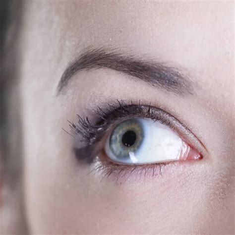 Red eyes allergy Stock Photos, Royalty Free Red eyes allergy Images ...