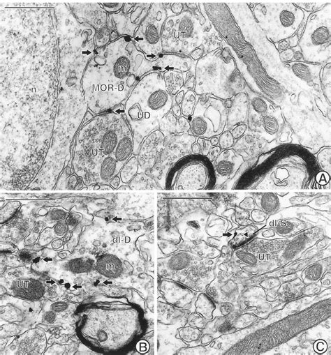 Electron Micrographs Through The Acb Showing Single Mor Labeling And