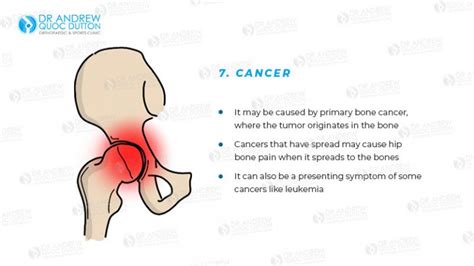 Hip Pain: A Comprehensive Guide | A/Professor Andrew Dutton