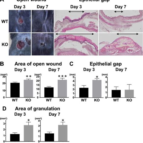 Wound Closure And Granulation Tissue Formation In Wild Type Mice Wt