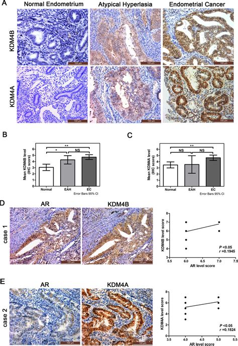 Expression Of Kdm B And Kdm A In Endometrial Tissues And Their