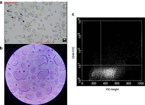 Characterization of granulosa cells obtained from PCOS patients and ...