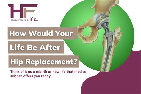 How Would Your Life Be After Hip Replacement Healthfinder