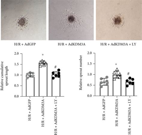 KDM3A Overexpression Ameliorated H R Induced CMEC Injury And