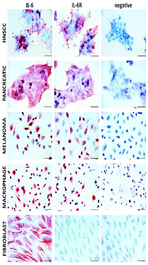 Immunocytochemical analysis of IL-6 and IL-6 receptor in cell lines ...