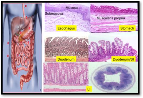 Upper Gi Tract Pathology Flashcards Quizlet