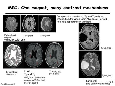 PPT - 12: MRI contrast mechanisms PowerPoint Presentation - ID:4901597