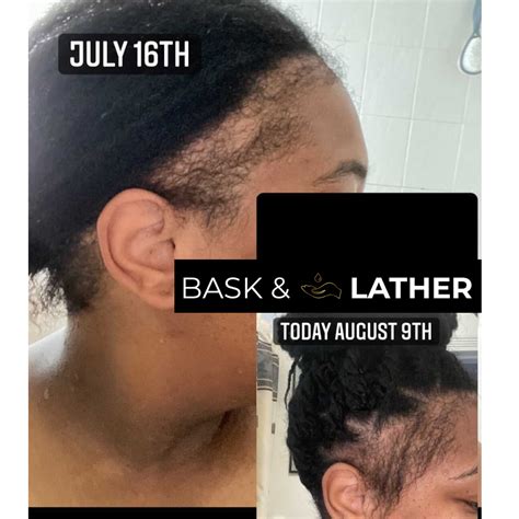 Rosemary Oil For Hair Growth Before And After Bask And Lather Co