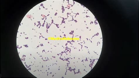 Enterococcus Faecium Introduction Morphology Pathogenicity