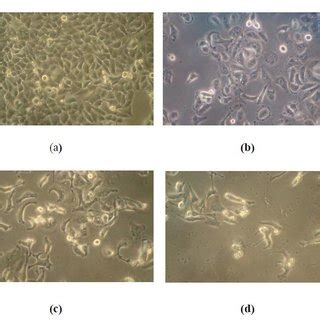 Phase Contrast Microscopy Of Sod Transfected Rpe Cells A Control