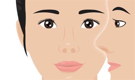 Short Nose Surgery – Face Plus Clinic Korea