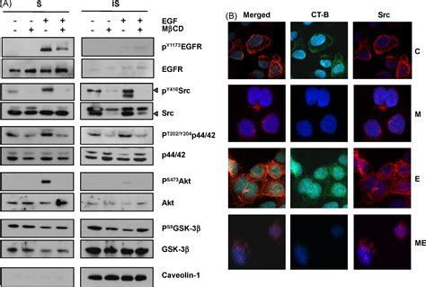 Lipid Raft Modulation Inhibits NSCLC Cell Migration Through