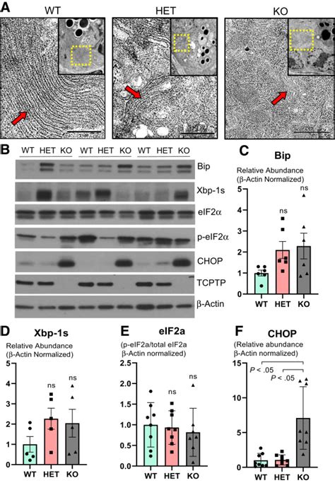 Ptpn Is A Critical Regulator Of Ileal Paneth Cell Viability And