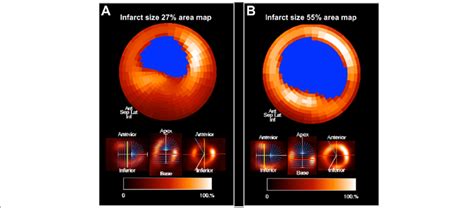 vertical long axis horizontal long axis  short axis slices