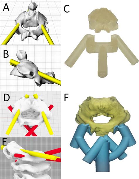 Trajectory Planning D Reconstruction Of C From Case From Posterior