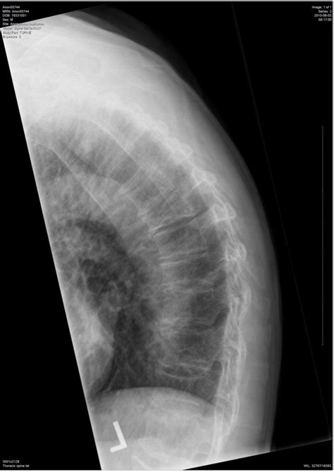component  sample items cceb