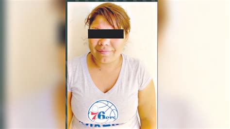 Mujer Ataca A Su Expareja Con Un Estilete Y Le Causa Heridas En Rostro