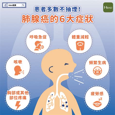 患者多數不抽煙！肺腺癌的6大症狀