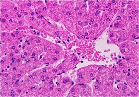 Hepatic Histology: Sinusoids