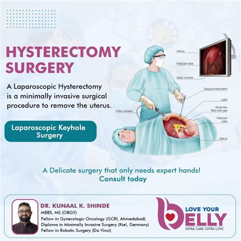 Hysterectomy Cost What To Expect In 2021 This Week In Libraries