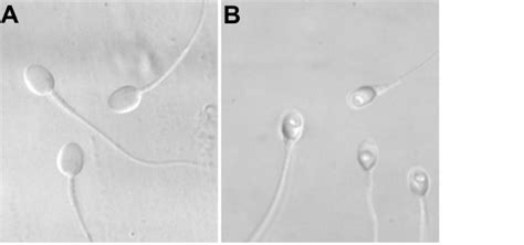 A Normal Sperm B Sperm With Large Nuclear Vacuoles Magnification