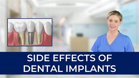 What Are The Side Effects Of Dental Implants Youtube