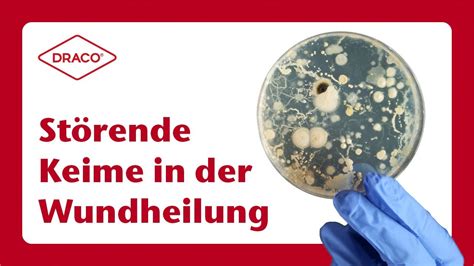 Störende Keime in der Wundheilung der DRACO Videoblog YouTube