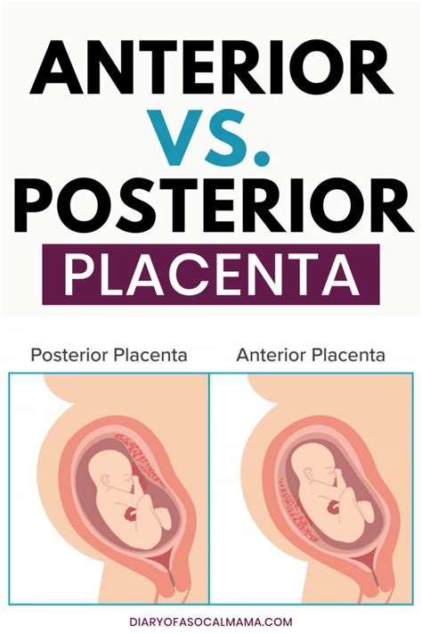 Posterior Placenta Means Boy Or Girl Reportwire