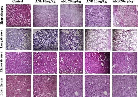 Effect Of ANL And ANB 10 Mg Kg Bw And 20 Mg Kg Bw Treated For 21 Days