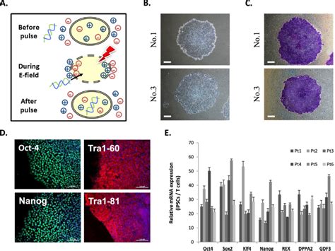 Generation And Characterization Of Ipscs Derived From Patients With Amd