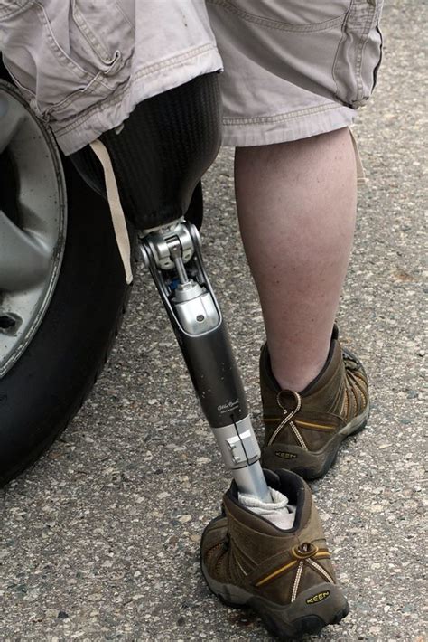 A Step Forward For Bionic Legs Science In The News