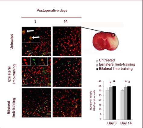 Nestin Glial Fibrillary Acidic Protein Gfap Positive Cells In The