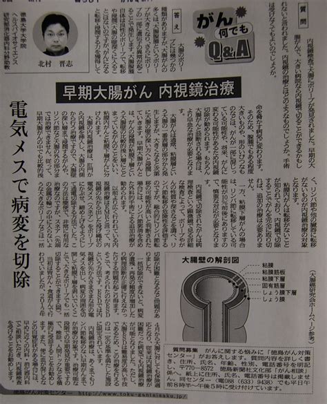 徳島新聞｢がん何でもqanda｣に掲載されました。 │ トピックス │ 新着情報 │ 徳島大学病院 がん診療連携センター